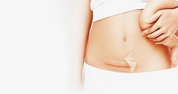 Γιατί τα παχιά φύλλα ουλής από σιλικόνη είναι τόσο δημοφιλή;